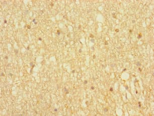 Polyclonal Rabbit anti-Human HOMER3 / Homer 3 Antibody