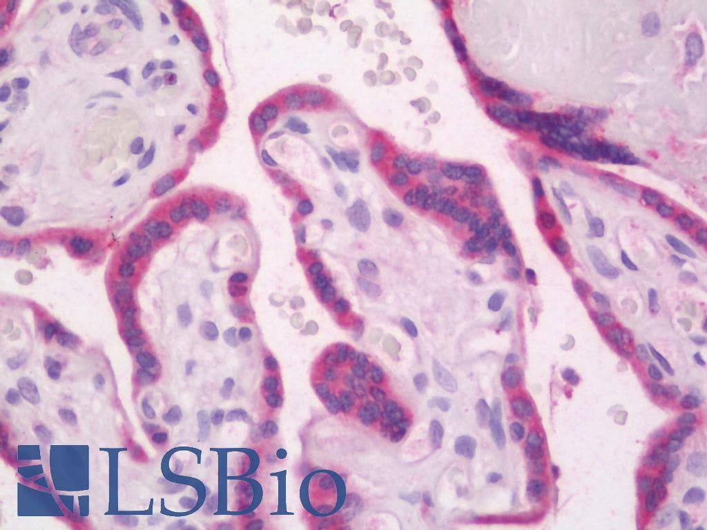 IHC-plus™ RAB27B Antibody (C-Terminus)