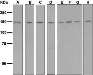 IHC-plus™ HYOU1 / ORP150 Antibody (Internal, clone EPR5890)