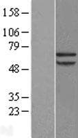 PRCC / RCCP1 Protein (Over-Expression Lysate Myc-DDK (Flag))