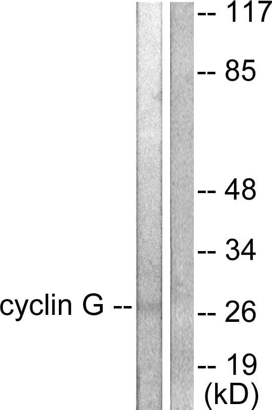 RPS6KB1 / P70S6K / S6K Antibody