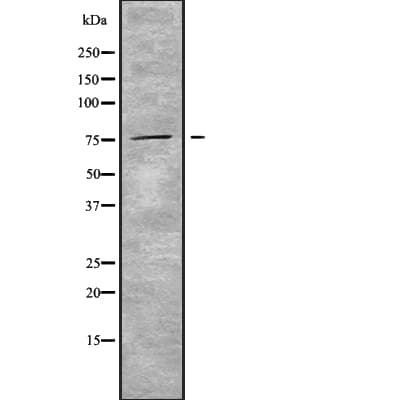 Polyclonal Rabbit anti-Human RPAP3 / FLJ21908 Antibody (WB)