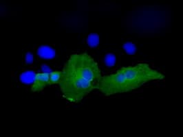 Monoclonal Mouse anti-Human PSMC3 Antibody (clone OTI1C10, IHC, IF, WB)