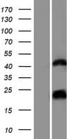 Human hCG_1657980 Protein (Over-Expression Lysate Myc-DDK (Flag))