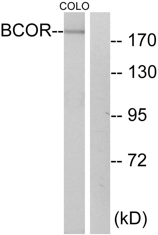 BCOR Antibody (aa1231-1280)