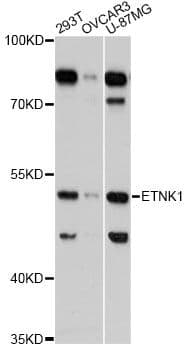 Polyclonal Rabbit anti-Human ETNK1 / Ethanolamine Kinase 2 Antibody (WB)