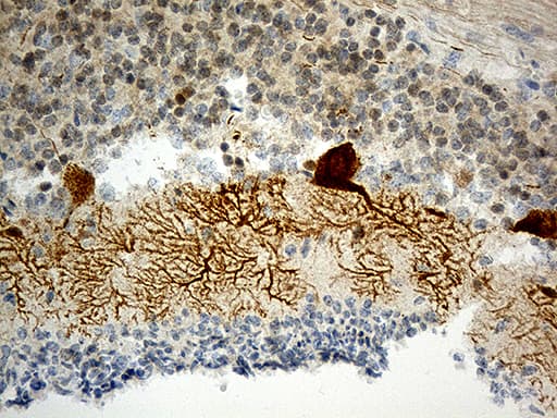 Monoclonal Mouse anti-Human HOMER1 / Homer 1 Antibody (clone OTI7G10, aa1-354, IHC, WB)