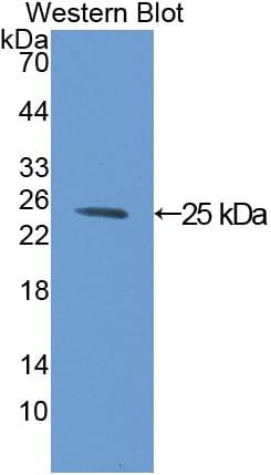 GC1qR / C1QBP Antibody (aa72-279)