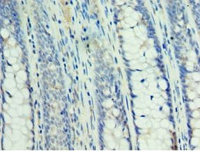 SMAD3 Antibody (aa1-230)