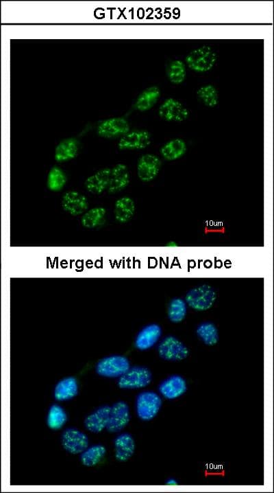 NUP62 Antibody (aa294-522)