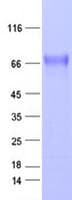Human EPHA5 / EPH Receptor A5 Protein (Recombinant DDK,C-terminus)