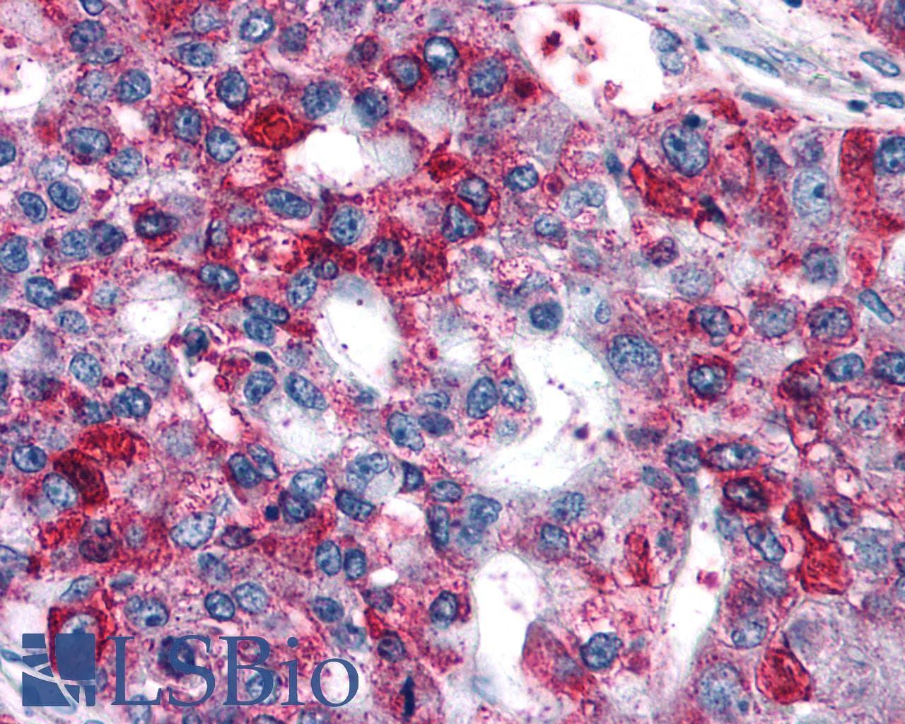 PathPlus™ GPR82 Antibody (Cytoplasmic Domain)