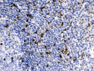 APOBEC3G / CEM15 Antibody