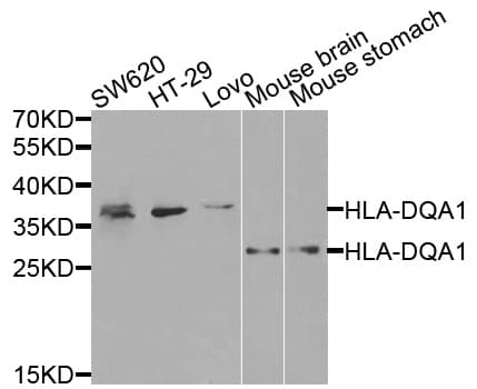 IHC-plus™ Polyclonal Rabbit anti-Human HLA-DQA1 Antibody (IHC, WB)
