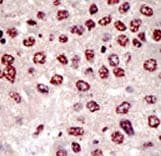 UFD2A / UBE4B Antibody (aa112-142)