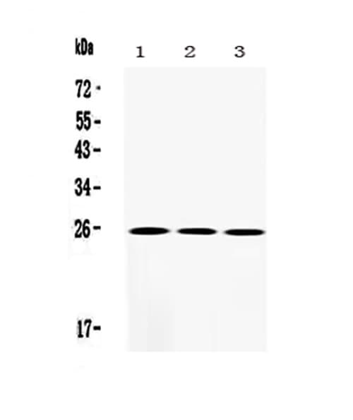 Polyclonal Rabbit anti-Human SOD2 / Mn SOD Antibody (aa45-62, IHC, WB)