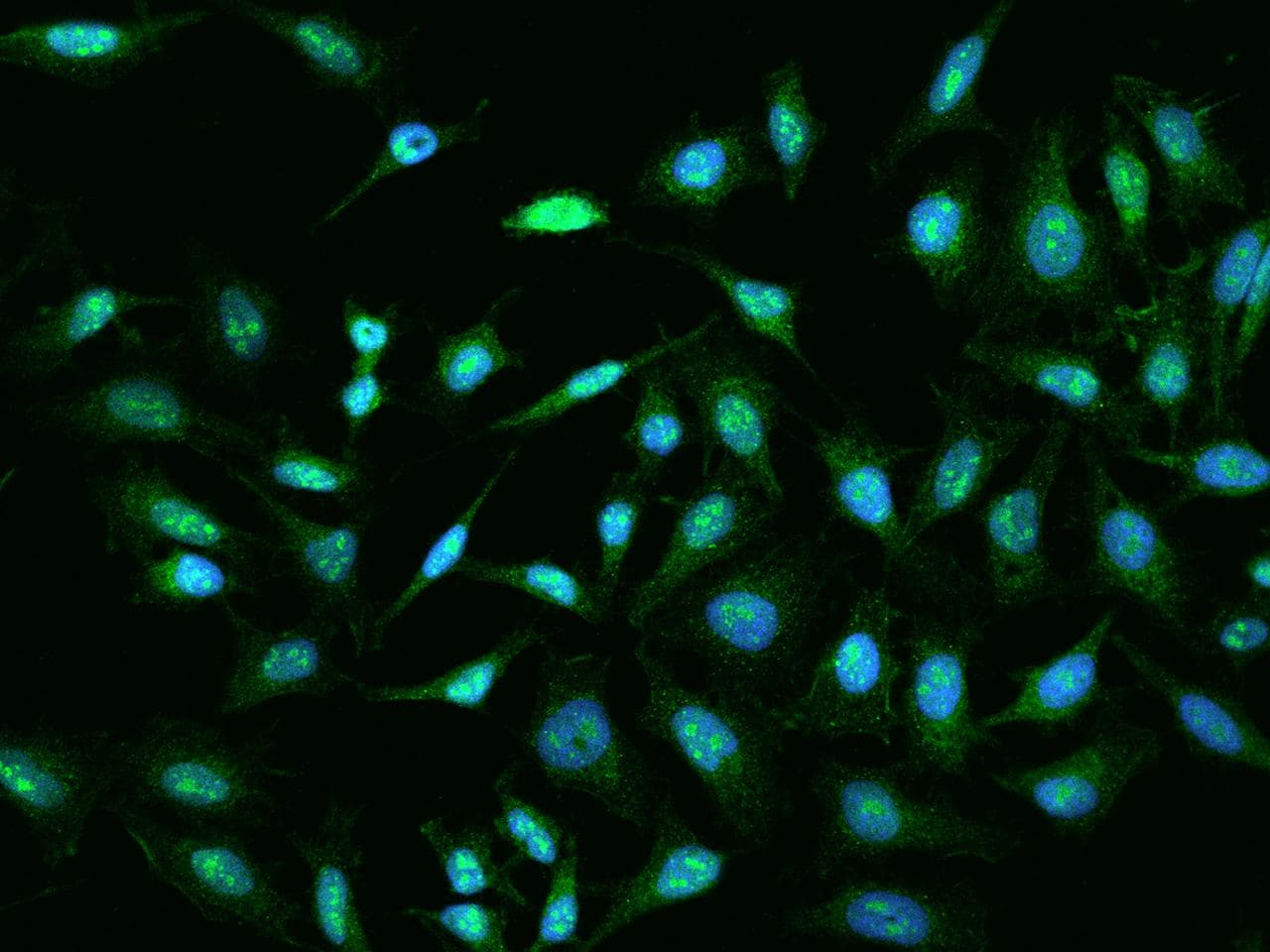 Polyclonal Rabbit anti-Human TXNDC3 Antibody (IF)