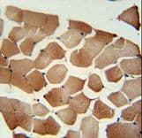 Polyclonal Rabbit anti-Human FLCN / Folliculin Antibody (aa505-534, IHC, WB)