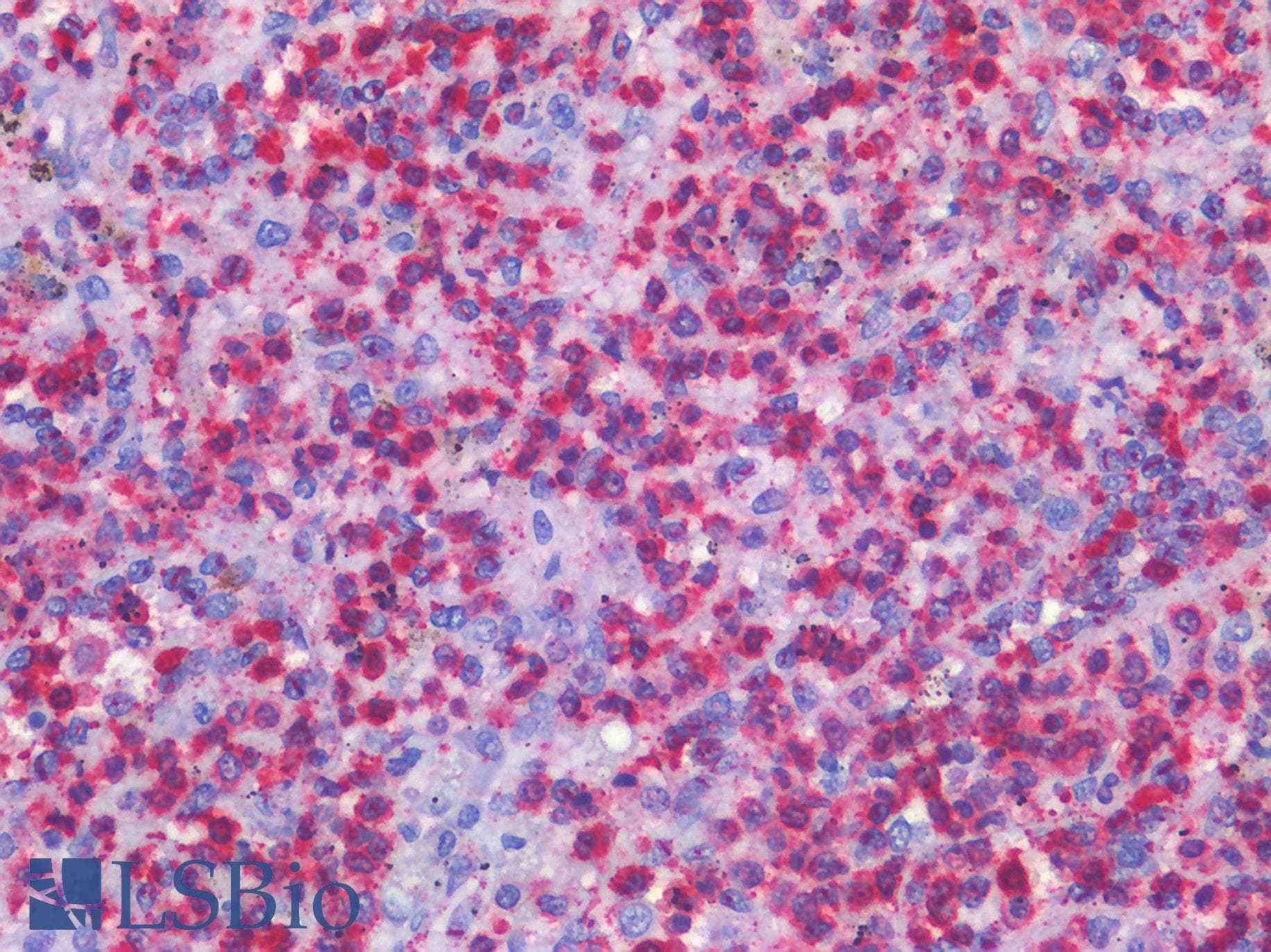 IHC-plus™ SMO / Smoothened Antibody (aa68-117)