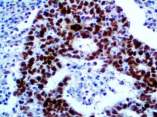 MDM2 Antibody