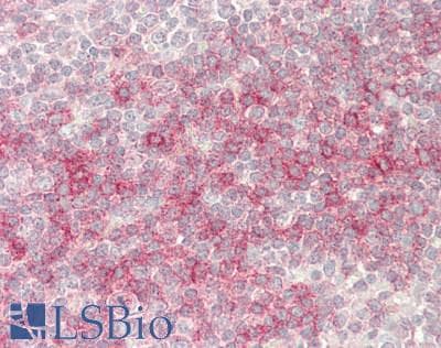 IHC-plus™ MCL1 / MCL 1 Antibody (clone 10C5)