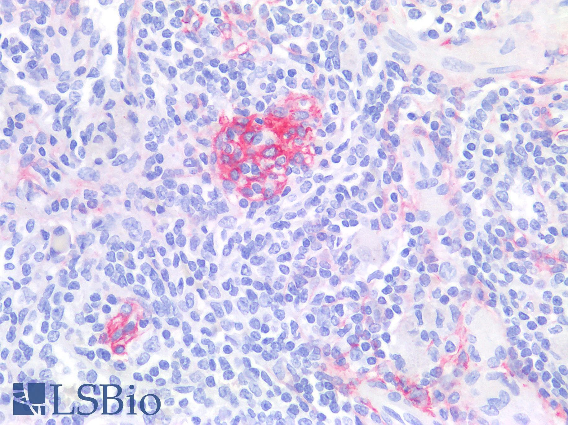 PathPlus™ NGFR / CD271 / TNR16 Antibody (clone NGFR5)