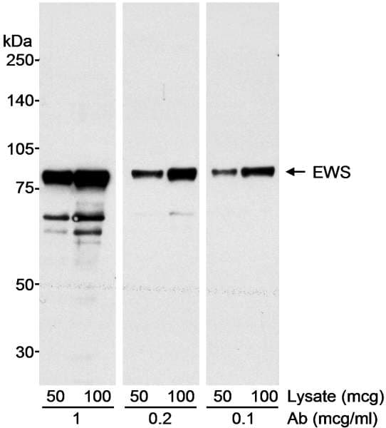 EWSR1 / EWS Antibody (aa1-50)