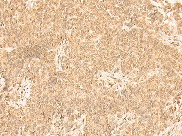 ST8SIA4 Antibody