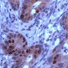 Polyclonal Rabbit anti-Human RB1 / Retinoblastoma / RB Antibody (C-Terminus, IHC)