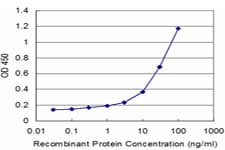 IHC-plus™ HSPA13 Antibody (clone 1H8)