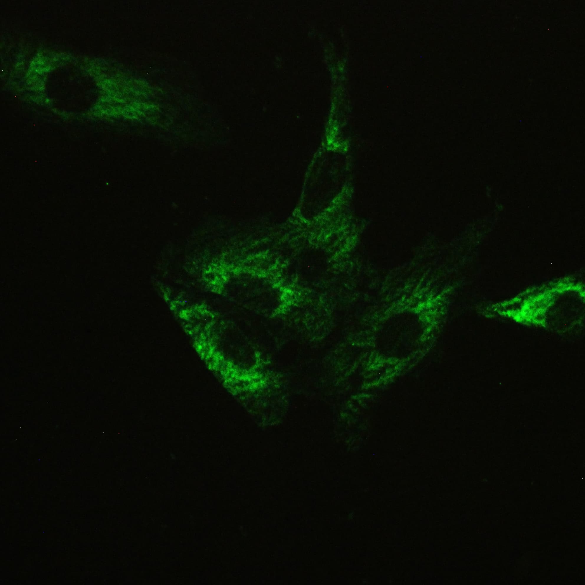 ATXN2 / SCA2 / Ataxin-2 Antibody (aa1293-1313)