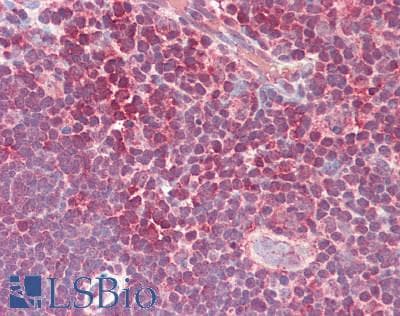 IHC-plus™ Polyclonal Rabbit anti-Human HAVCR2 / TIM-3 Antibody (IHC, IF, WB)