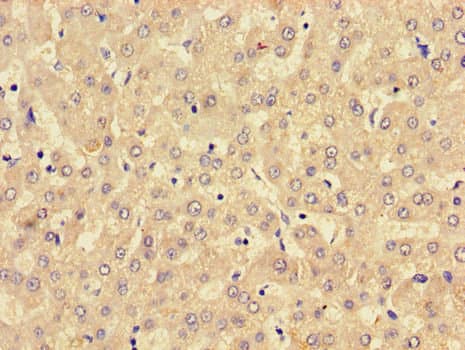 IHC-plus™ Polyclonal Rabbit anti-Human MBOAT5 / C3F Antibody (IHC)