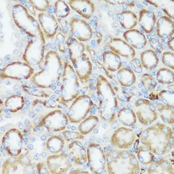 Polyclonal Rabbit anti-Human HTRA3 Antibody (IHC, WB)