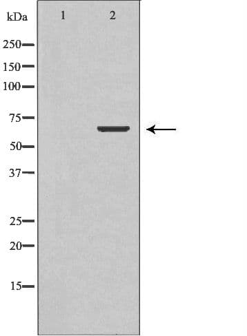 TCTN3 Antibody