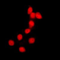 Polyclonal Rabbit anti-Human Histone H2B Antibody (N-Terminus, IHC, IF, WB)