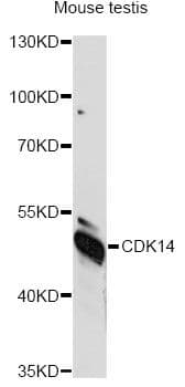 Polyclonal Rabbit anti-Human PFTK1 / CDK14 Antibody (WB)