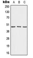 IHC-plus™ AKAP5 / AKAP79 Antibody (N-Terminus)