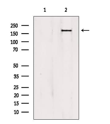 Polyclonal Rabbit anti-Human PTPN23 / HDPTP Antibody (IHC, IF, WB)