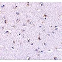 Polyclonal Rabbit anti-Human NANOS1 / NOS1 Antibody (IHC, IF, WB)