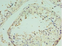 Polyclonal Rabbit anti-Human TICAM2 / TRAM Antibody (aa1-235, IHC)
