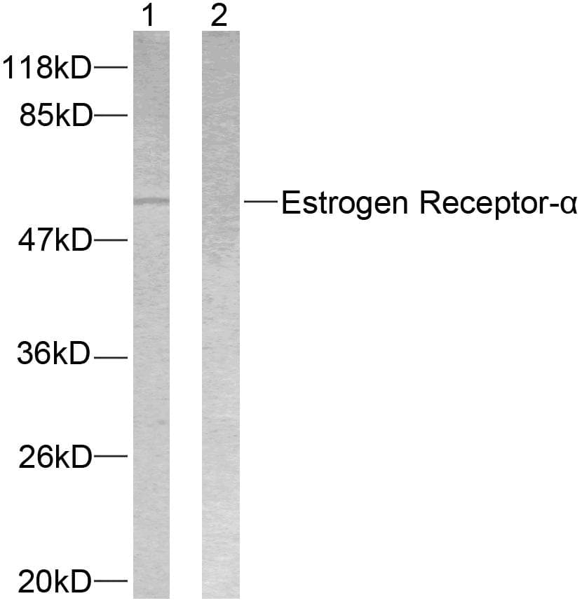 ER Alpha / Estrogen Receptor Antibody (p118)