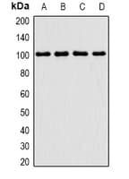 Trimethylguanosine Synthase 1 Antibody