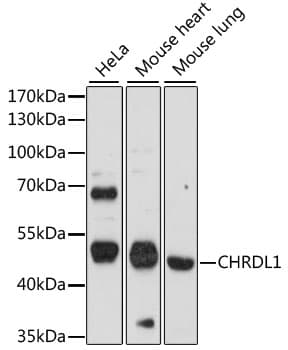 Polyclonal Rabbit anti-Human CHRDL1 Antibody (WB)
