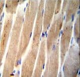Polyclonal Rabbit anti-Human CLEC4F Antibody (aa311-339, IHC, WB)