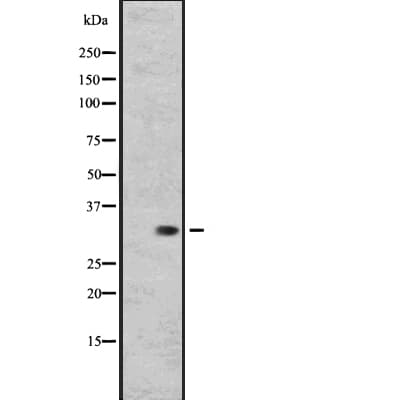 Polyclonal Rabbit anti-Human RGR Antibody (IHC, WB)