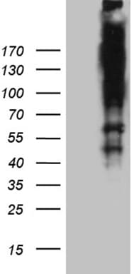 ARID1A / BAF250 Antibody (aa1986-2285, clone OTI4D1)