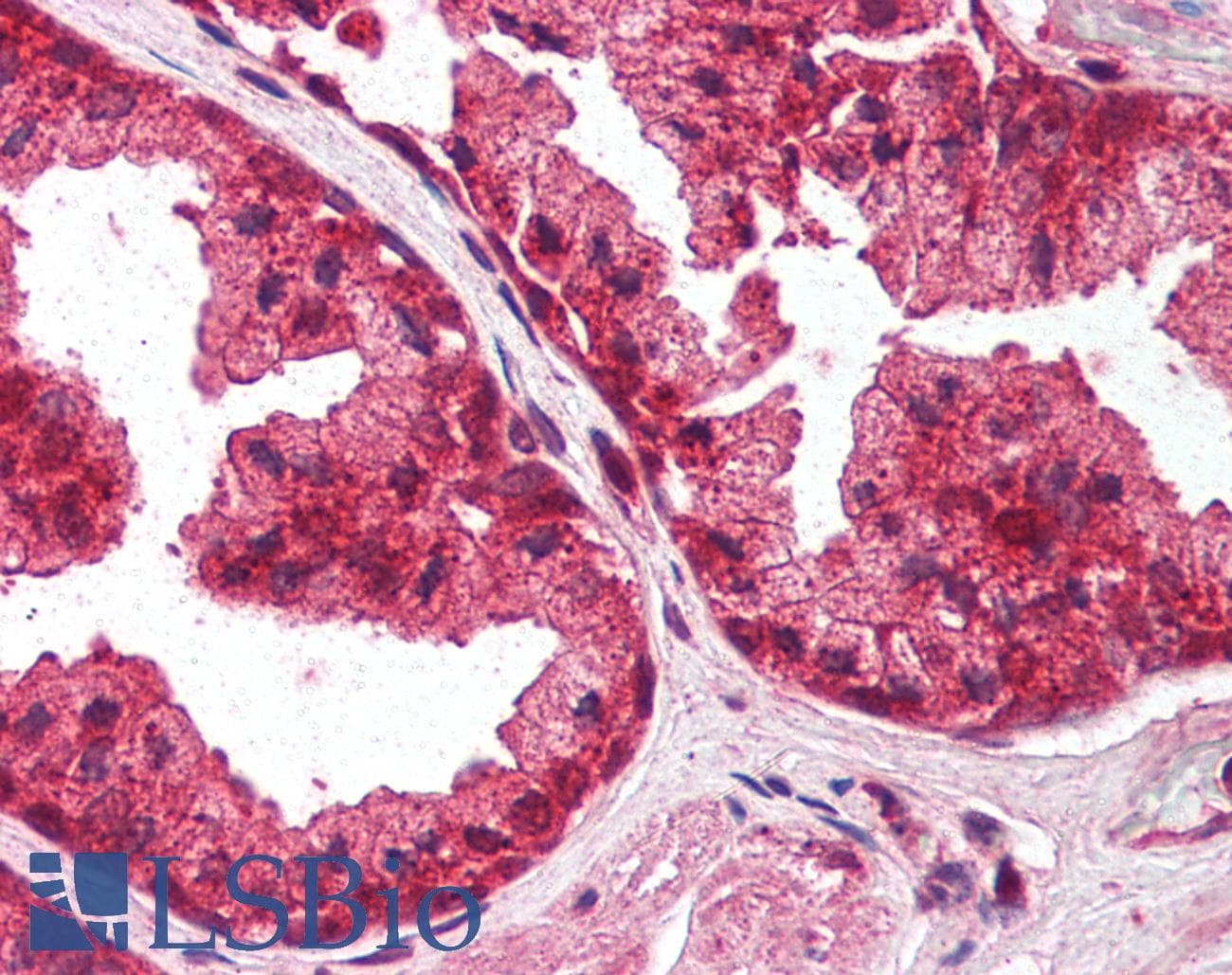 IHC-plus™ Polyclonal Goat anti-Human PLEKHA8 Antibody (aa428-440, IHC)