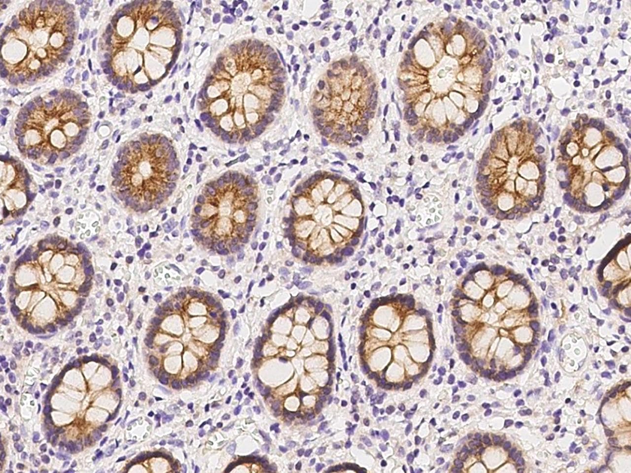 MAP7 Antibody