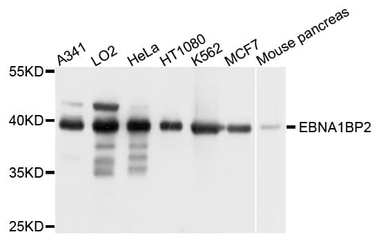 EBNA1BP2 Antibody